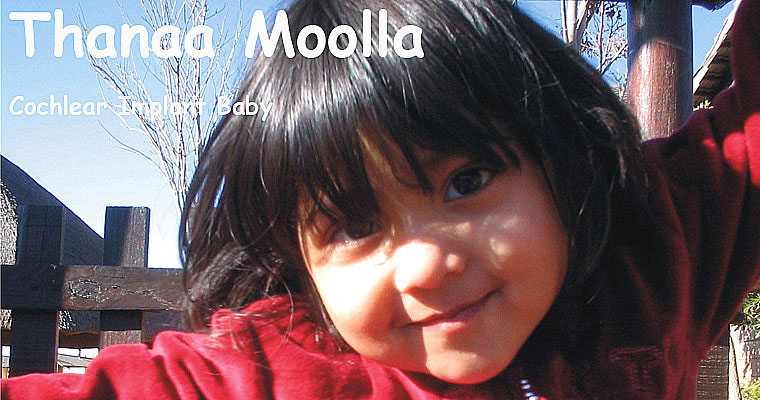 Thanaa Moolla, the cochlea baby waiting for a cochlear implant to help her hear the dogs bark and the cats meow